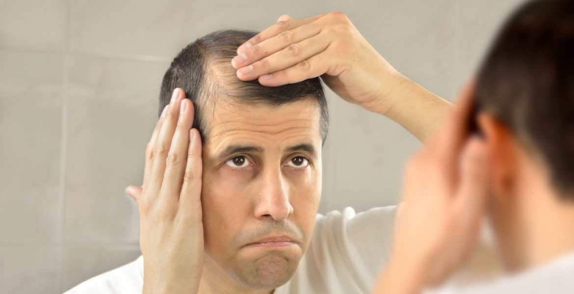Falsos mitos sobre la caída del cabello