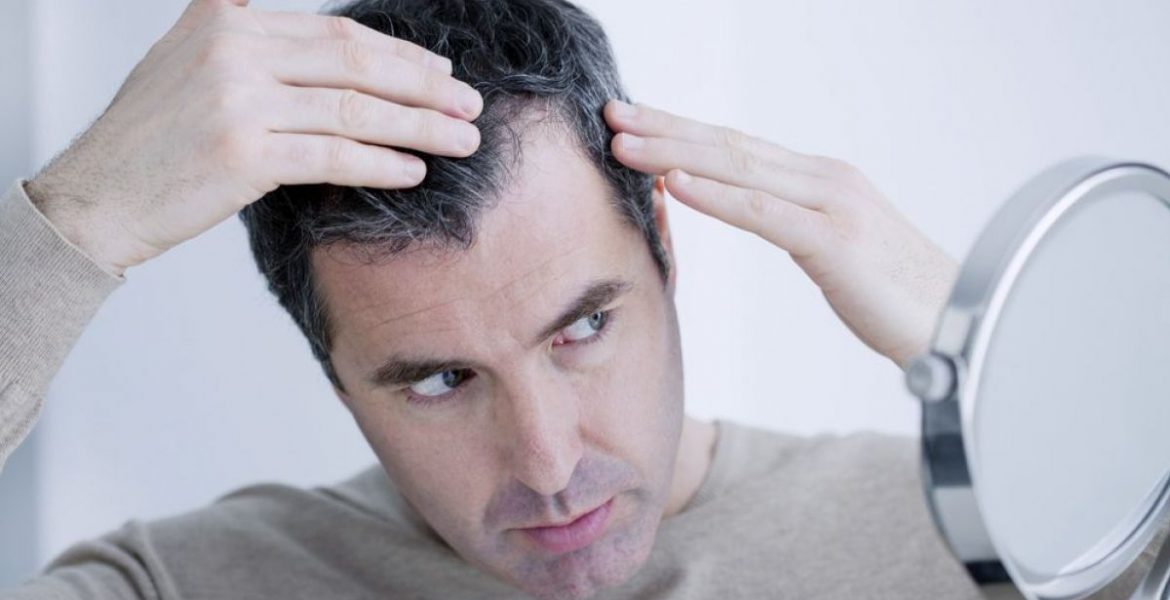 Hábitos que favorecen la caída del pelo
